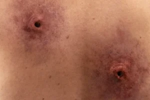 Prothèse de blessure de flèches - Morphorium SFX