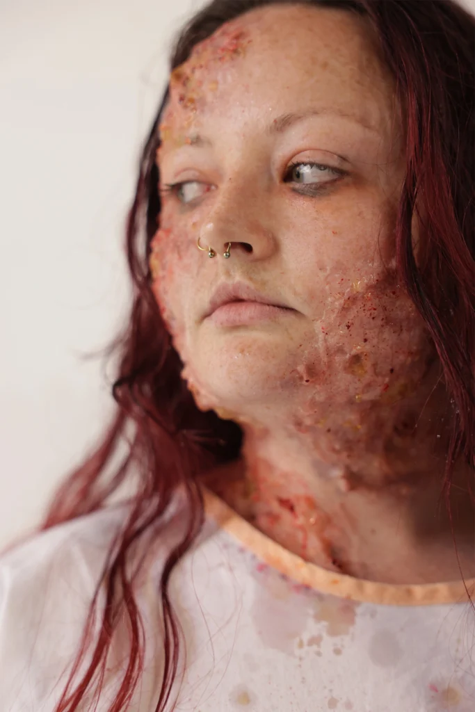 Maquillage FX d'effet de brûlure profonde sur le visage réalisé avec prothèse