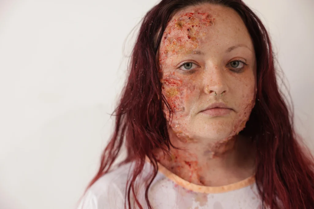 Maquillage FX d'effet de brûlure profonde sur le visage réalisé avec prothèse
