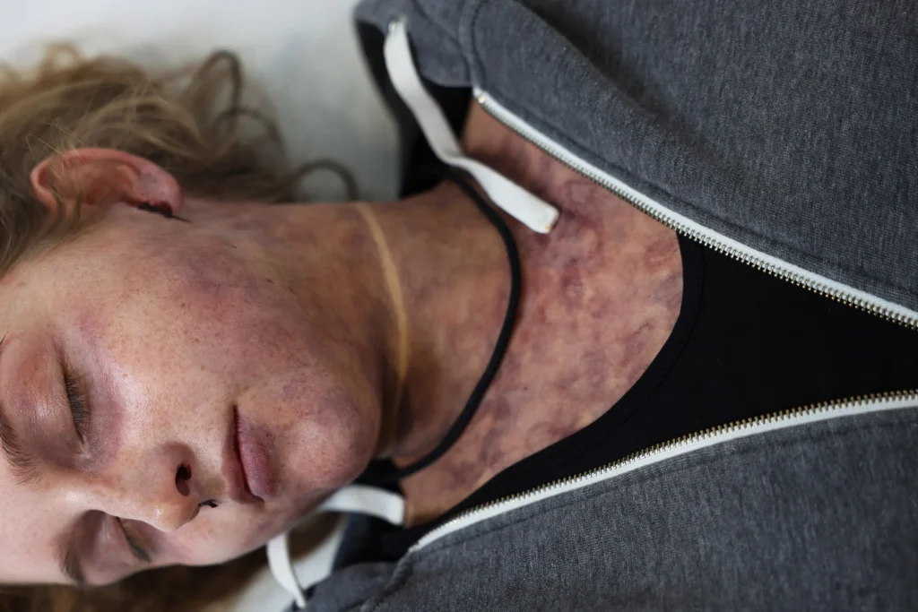 Maquillage SFX simulant des marques de strangulation réalistes sur le cou pour un shooting photo d'effets spéciaux