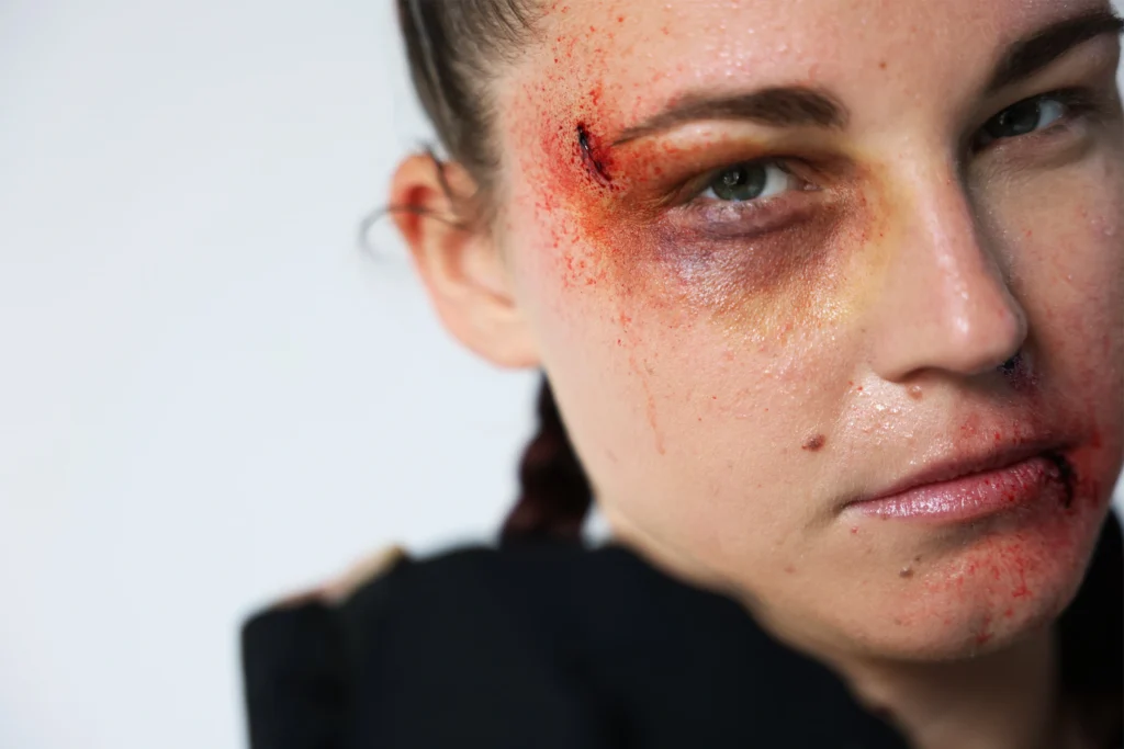 Maquillage d’effets spéciaux simulant des ecchymoses, coupures et gonflements sur le visage après coups