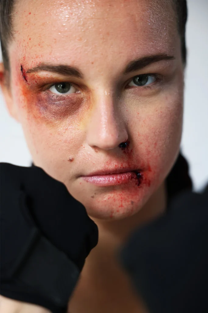 Maquillage d’effets spéciaux simulant des ecchymoses, coupures et gonflements sur le visage après coups